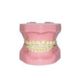 TM-B3-03 Ortho Model with Ceramic Bracket